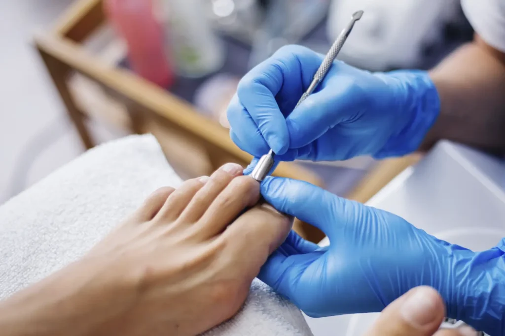 Diplomado en podología estética