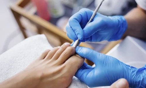 Diplomado en podología estética
