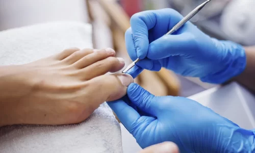 Diplomado en podología estética