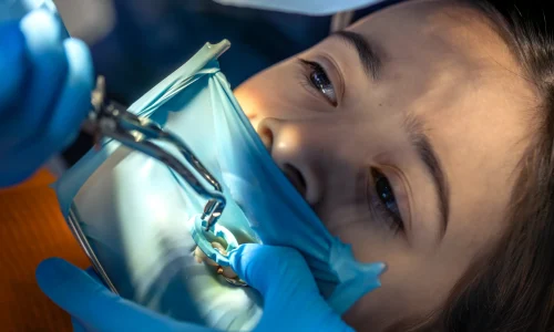 Curso en Tratamientos de Hipersensibilidad Dental