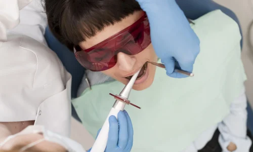 Diplomado en Técnicas Avanzadas de Blanqueamiento Dental