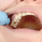 ISEIE-maestria-en-odontologia-estetica-y-restauradora