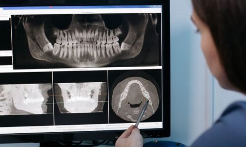 Curso de Odontología Restauradora Basados en Nuevas Tecnologías, Curso de Odontología Restauradora Basados en Nuevas Tecnologías, Odontología Restauradora, odontología, restauración de los dientes, desgaste dental, radiología digital, odontología, ISEIE, Institución Superior Estudios Innovadores Europeos, restauración dental, odontología restauradora, rehabilitación dental, profesionales de la odontología, Odontología Restauradora, Tejido Dental, Enfermedad Periodontal, Desgaste Dental, Forma de los Dientes, Rehabilitación Oral, Prótesis Dentales, Rehabilitación Oral Asistida por Ordenador, Radiología Digital, Restauraciones Dentales, Odontología Digital, Odontología Restauradora