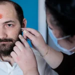Maestria-en-Acne-Protocolos-Clinicos-Cicatrices-y-Abordaje-Combinado-3