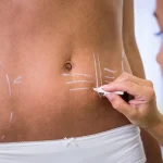 Maestria-en-Cirugia-de-Cicatrices-y-Tratamiento-Anticicatriz-2