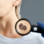 Maestria-en-Complicaciones-Cutaneas-por-Estetica-Necrosis-Granulomas-e-Infecciones-1