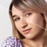Maestria-en-Hiperpigmentaciones-Melasma-PIH-y-Tratamientos-Combinados-1
