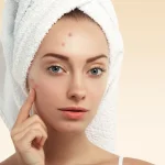Maestria-en-Tratamiento-del-Acne-1