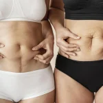 Máster en Abdominoplastia y Cirugía Postbariátrica 2