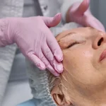 Maestría en Enfermería en Peelings, Microneedling y Procedimientos Dermoestéticos 2