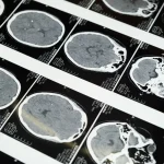 Maestria en Radiología y Técnicas de Imagen para el Diagnóstico Clínico